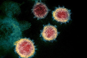 Transmission electron micrograph of SARS-CoV-2 virions with visible coronae.